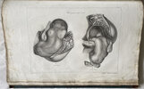 Another image of OSTETRICIA TEORICO-PRATICA by RAFFAELE, Giovanni.