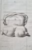 Another image of PUELLAE MONSTROSAE DELINEATIO, by [TERATOLOGY.] CAMPEN, Michael Johan van.