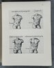 Another image of COLLECTION DE CHIRURGIENS GRECS AVEC DESSINS ATTRIBUÉS AU PRIMATICE. by [GUIDI, Guido, or VIDIUS, Vidus.] BIBLIOTHÈQUE NATIONALE DÉPARTEMENT DES MANUSCRITS, and ORMONT, Henri Auguste (editor).