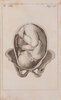 Another image of Anfangsgründe der Geburtshülfe, in Fragen und Antworten, zum Unterrichte der Hebammen. Aus dem französischen nach der dritten Ausgabe übersetzt von L. G. Morel. by BAUDELOCQUE, [Jean-Louis]. [Gabriel Louis François Anaclet] MOREL, translator.