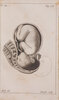 Another image of Anfangsgründe der Geburtshülfe, in Fragen und Antworten, zum Unterrichte der Hebammen. Aus dem französischen nach der dritten Ausgabe übersetzt von L. G. Morel. by BAUDELOCQUE, [Jean-Louis]. [Gabriel Louis François Anaclet] MOREL, translator.